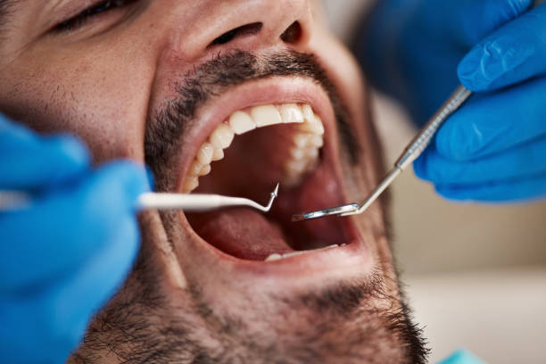 Oral Cancer Screening in Long Branch, NJ